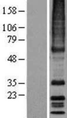 Western Blot: MRGX3 Overexpression Lysate [NBP2-04411]