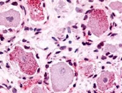 Immunohistochemistry-Paraffin: MRGX4 Antibody - BSA Free [NLS2729]