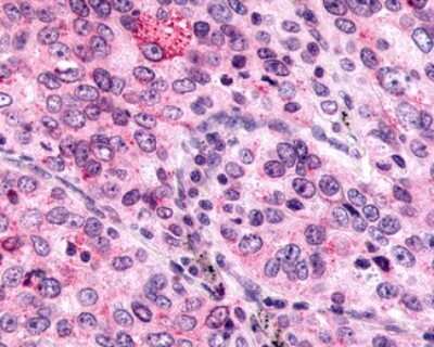 Immunohistochemistry-Paraffin: MRGX4 Antibody - BSA Free [NLS2729]