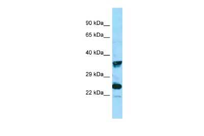 Western Blot: MRGX4 Antibody [NBP2-84171]