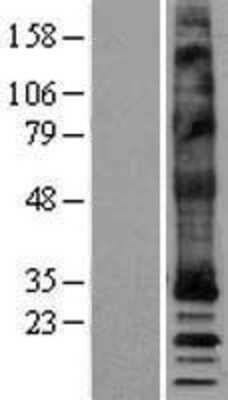 Western Blot: MRGX4 Overexpression Lysate [NBP2-04412]