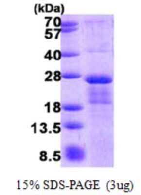 SDS-PAGE: Recombinant Human CYREN His Protein [NBP2-22782]