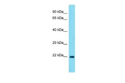 Western Blot: MRLC2 Antibody [NBP2-85313]