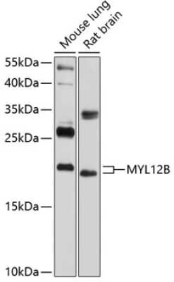 Western Blot: MRLC2 AntibodyBSA Free [NBP3-05574]