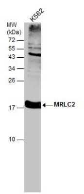 Western Blot: MRLC2 Antibody [NBP3-12870]
