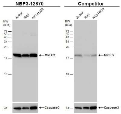 Western Blot: MRLC2 Antibody [NBP3-12870]