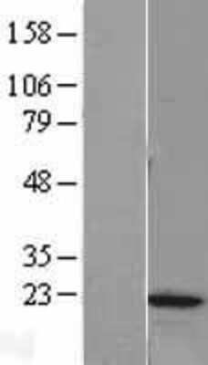 Western Blot: MRLC2 Overexpression Lysate [NBL1-13229]