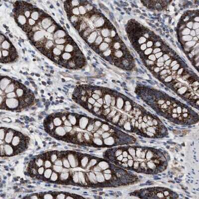 Immunohistochemistry-Paraffin: MRM1 Antibody [NBP1-83597]