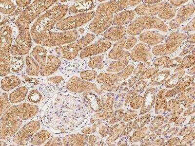 Immunohistochemistry-Paraffin: MRM1 Antibody [NBP3-06318]