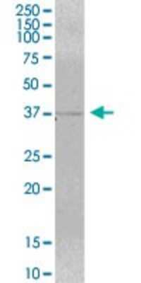 Western Blot: MRM1 Antibody [H00079922-B01P]