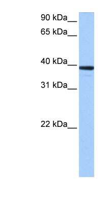 Western Blot: MRM1 Antibody [NBP1-57366]