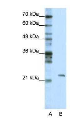 Western Blot: MRM1 Antibody [NBP1-57367]