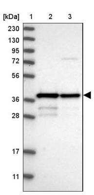 Western Blot: MRM1 Antibody [NBP1-83597]