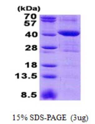 SDS-PAGE: Recombinant Human MRM1 His Protein [NBP2-23245]