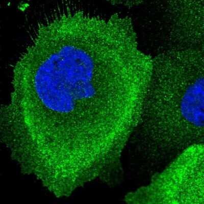 Immunocytochemistry/ Immunofluorescence: MRN Complex Interacting Protein Antibody [NBP2-14417]