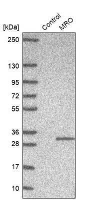 Western Blot: MRO Antibody [NBP2-13608]