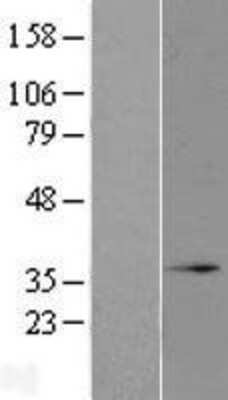 Western Blot: MRO Overexpression Lysate [NBL1-13231]