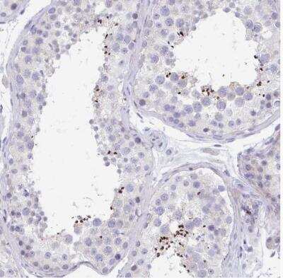 Immunohistochemistry-Paraffin: MROH2B Antibody [NBP2-32466]