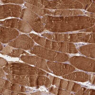 Immunohistochemistry-Paraffin: MROH6 Antibody [NBP2-49541]