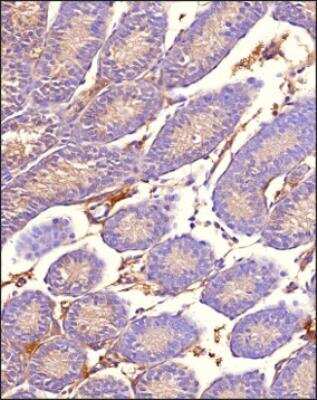 Immunohistochemistry-Paraffin: MRP1 Antibody (IU5C1) - BSA Free [NB110-57131]