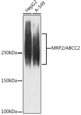 Western Blot: MRP2 Antibody (6L3Z6) [NBP3-16817]