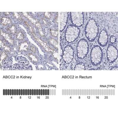 Immunohistochemistry-Paraffin: MRP2 Antibody [NBP3-17039]