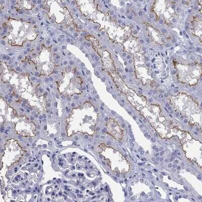 Immunohistochemistry-Paraffin: MRP2 Antibody [NBP3-17039]