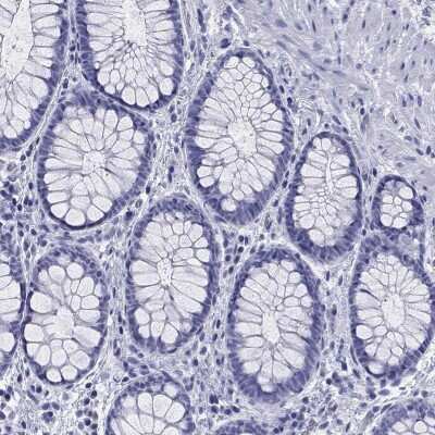 Immunohistochemistry-Paraffin: MRP2 Antibody [NBP3-17039]