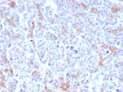 Immunohistochemistry-Paraffin: MRP3 Antibody (ABCC3/2971) - Azide and BSA Free [NBP2-79837]