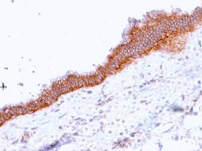Immunohistochemistry-Paraffin: MRP3 Antibody (ABCC3/2971) - Azide and BSA Free [NBP2-79837]