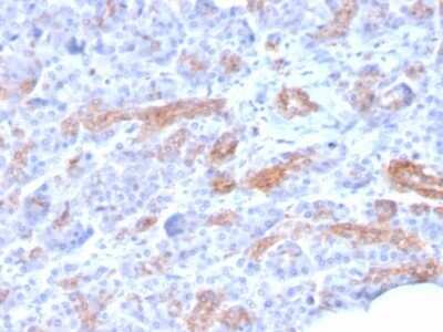 Immunohistochemistry-Paraffin: MRP3 Antibody (ABCC3/2971) - Azide and BSA Free [NBP2-79837]