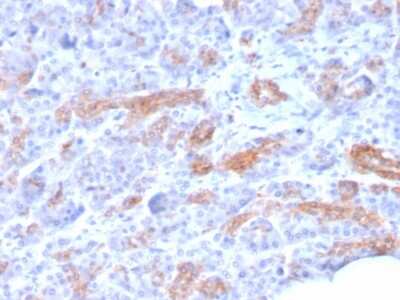 Immunohistochemistry-Paraffin: MRP3 Antibody (ABCC3/2971) [NBP2-79703]