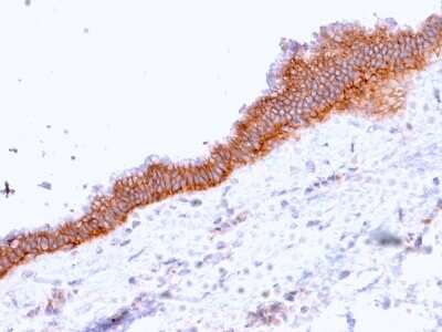 Immunohistochemistry-Paraffin: MRP3 Antibody (ABCC3/2971) [NBP2-79703]