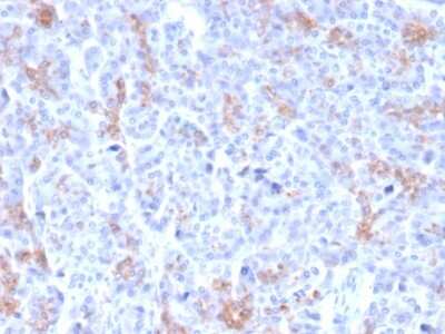 Immunohistochemistry-Paraffin: MRP3 Antibody (ABCC3/2971) [NBP2-79703]