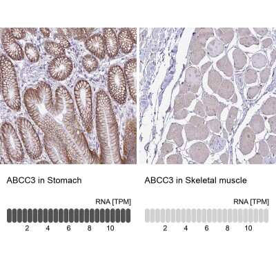 Immunohistochemistry-Paraffin: MRP3 Antibody [NBP2-37923]