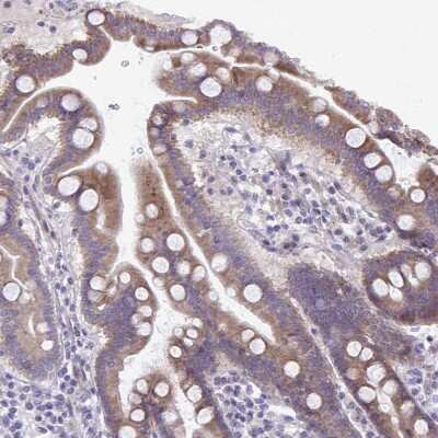 Immunohistochemistry-Paraffin: MRP3 Antibody [NBP2-37923]