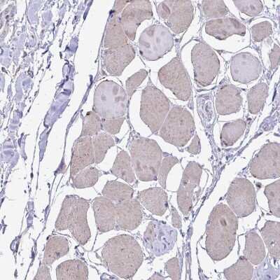 Immunohistochemistry-Paraffin: MRP3 Antibody [NBP2-37923]