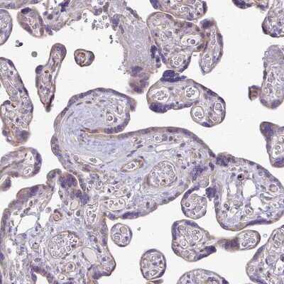 Immunohistochemistry-Paraffin: MRP3 Antibody [NBP2-37923]