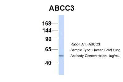 Western Blot: MRP3 Antibody [NBP1-59806]