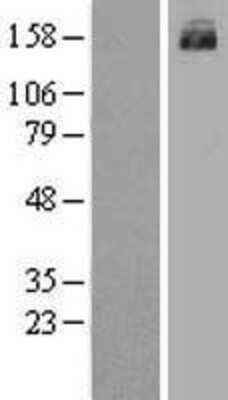 Western Blot: MRP3 Overexpression Lysate [NBL1-07178]