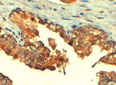 Immunohistochemistry-Paraffin: MRP4/ABCC4 Antibody [NB100-1471]