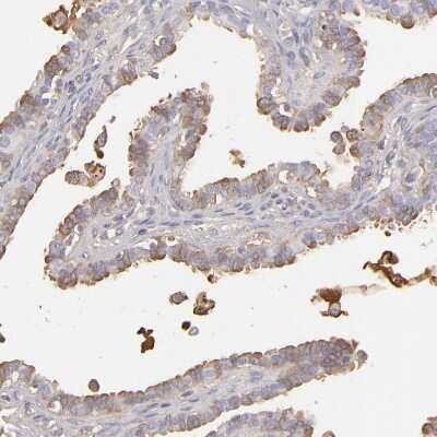 Immunohistochemistry-Paraffin: MRP4/ABCC4 Antibody [NBP1-84782]