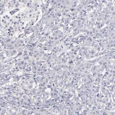 Immunohistochemistry-Paraffin: MRP4/ABCC4 Antibody [NBP1-84782]