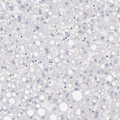 Immunohistochemistry-Paraffin: MRP4/ABCC4 Antibody [NBP1-84782]