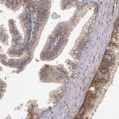 Immunohistochemistry-Paraffin: MRP4/ABCC4 Antibody [NBP1-84782]