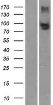 Western Blot: MRP4/ABCC4 Overexpression Lysate [NBP2-11422]