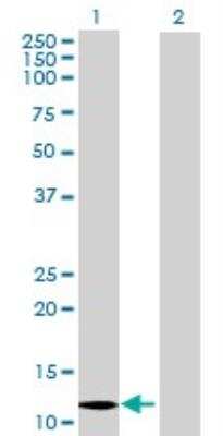 Western Blot: MRP6 293T Cell Transient Overexpression Lysate [H00000368-T01]