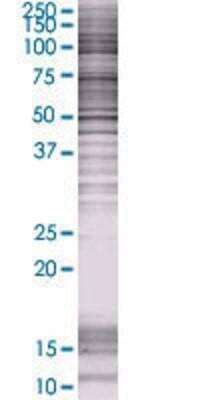 Western Blot: MRP6 293T Cell Transient Overexpression Lysate [H00000368-T01]