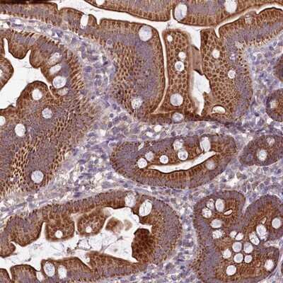 Immunohistochemistry-Paraffin: MRP63 Antibody [NBP1-90898]
