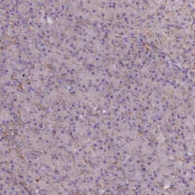 Immunohistochemistry-Paraffin: MRP63 Antibody [NBP1-90898]
